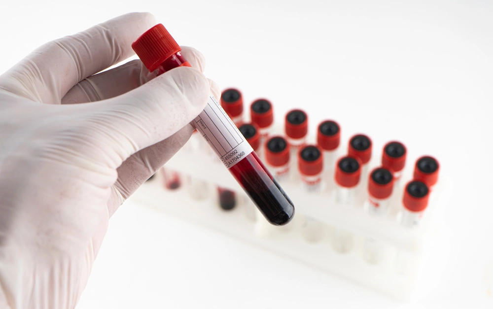 Etiquetashospitalares 1 Médico segurando exame de sangue